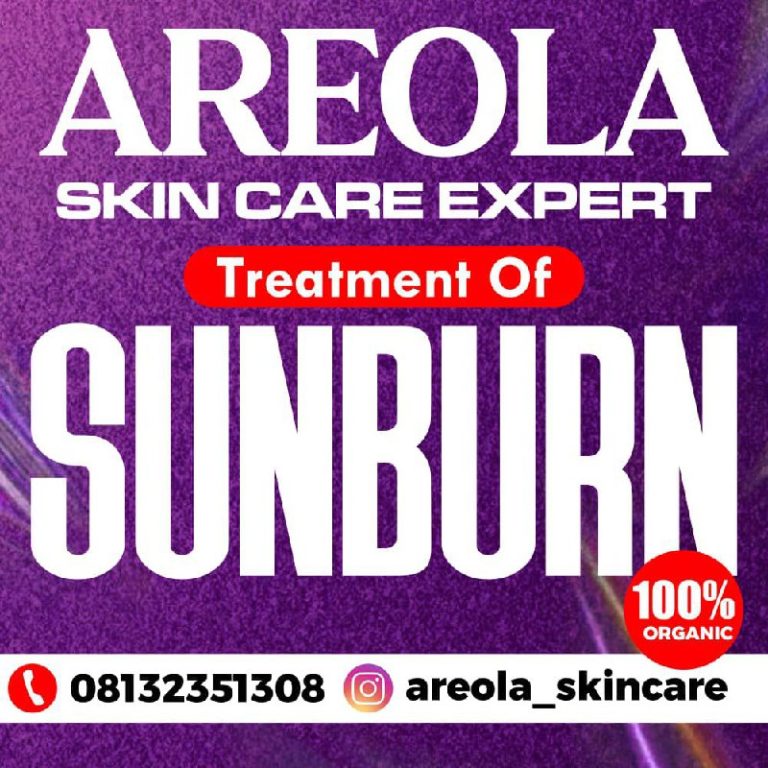 photo_5996939059198544503_x