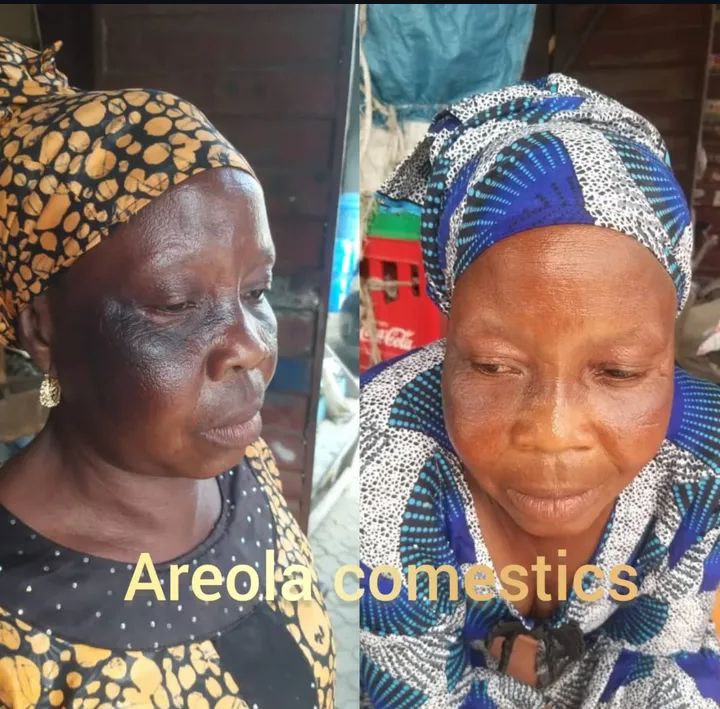 photo_5996939059198544527_x